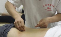 針灸初學者，你的持針手法正確嗎？